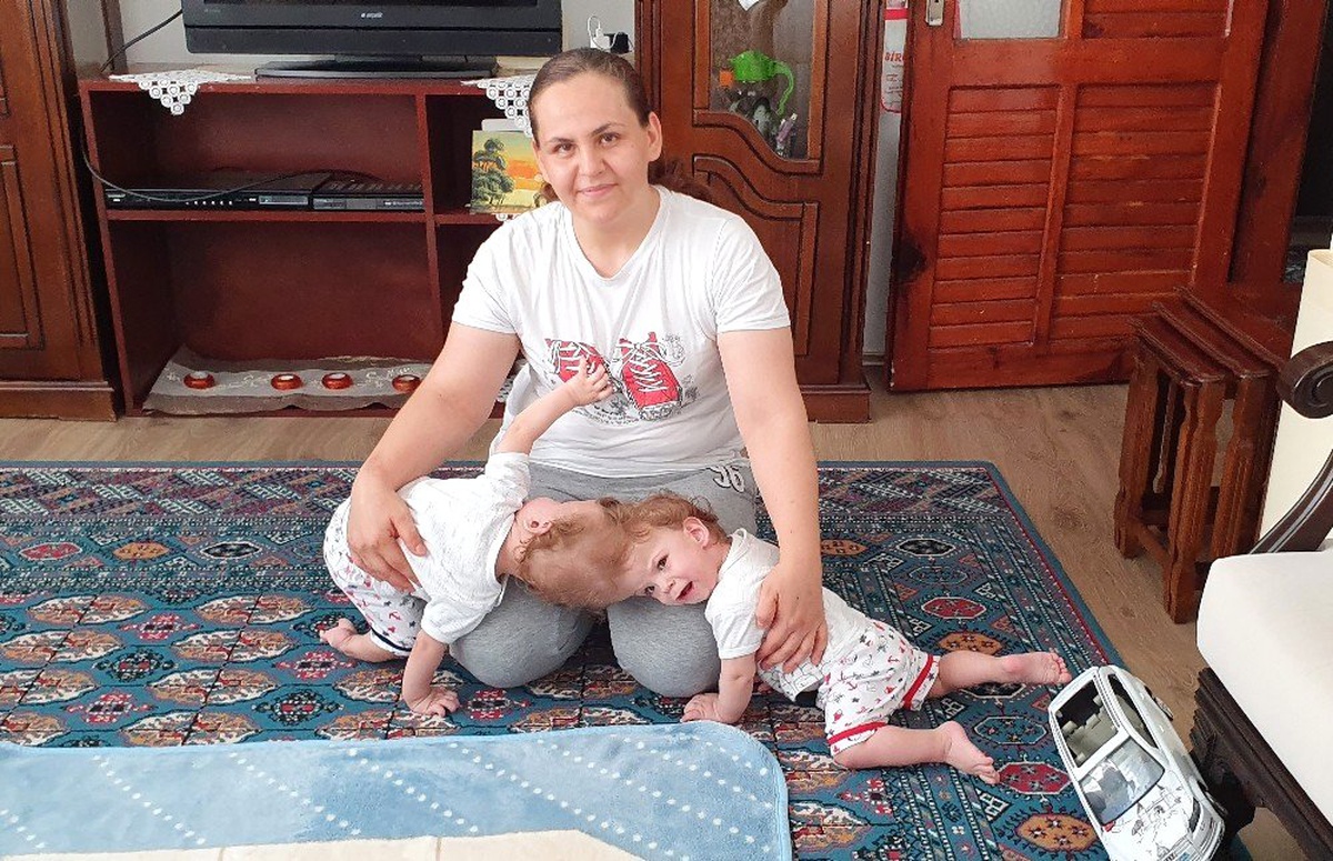 Kafadan yapışık siyam ikizleri ameliyatla ayrılarak sağlıklı bir şekilde yaşamlarını sürdürmelerini...
