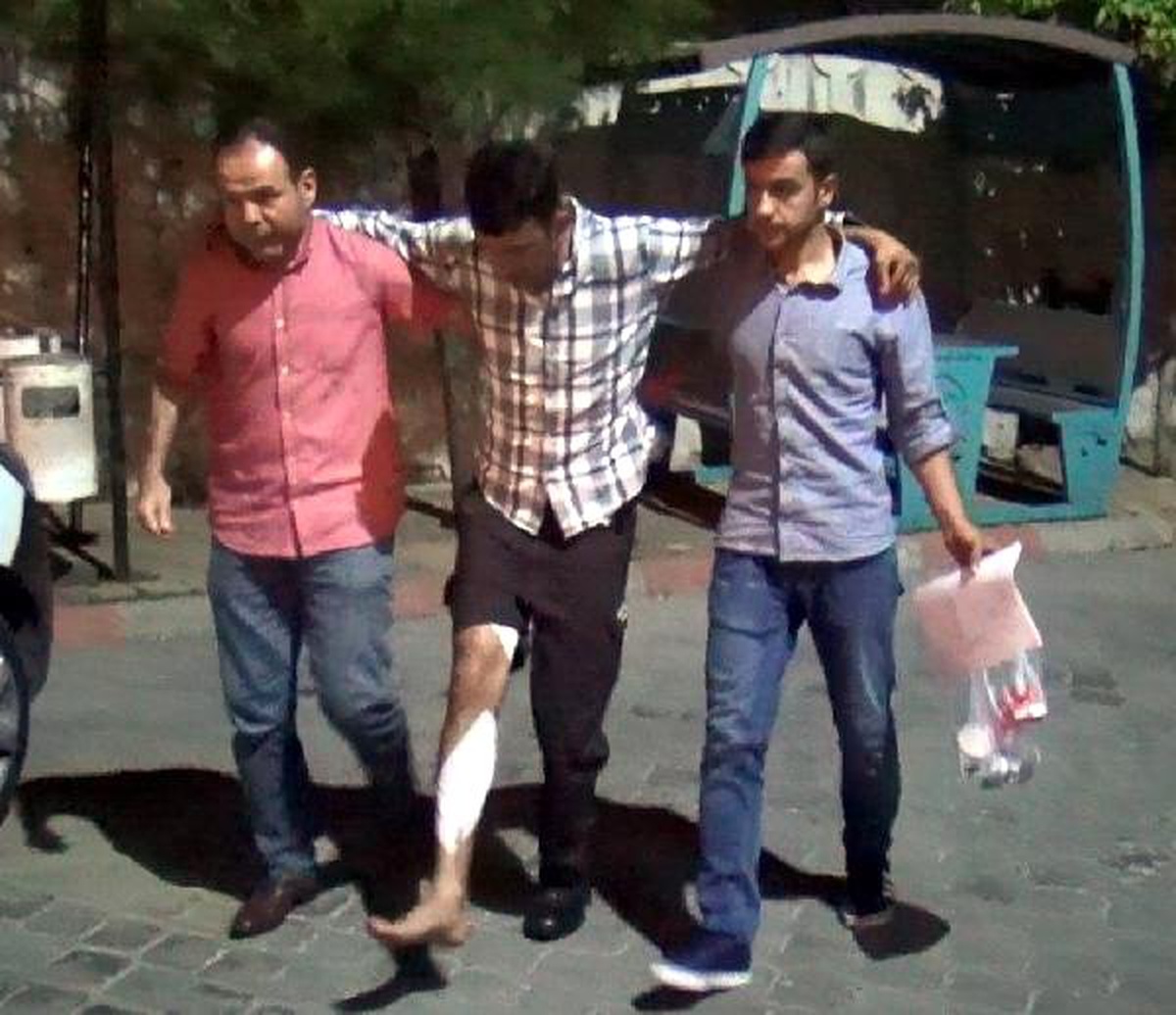 Kahramanmaraş\'ta kız kavgası: 1\'i bekçi, 2 yaralı