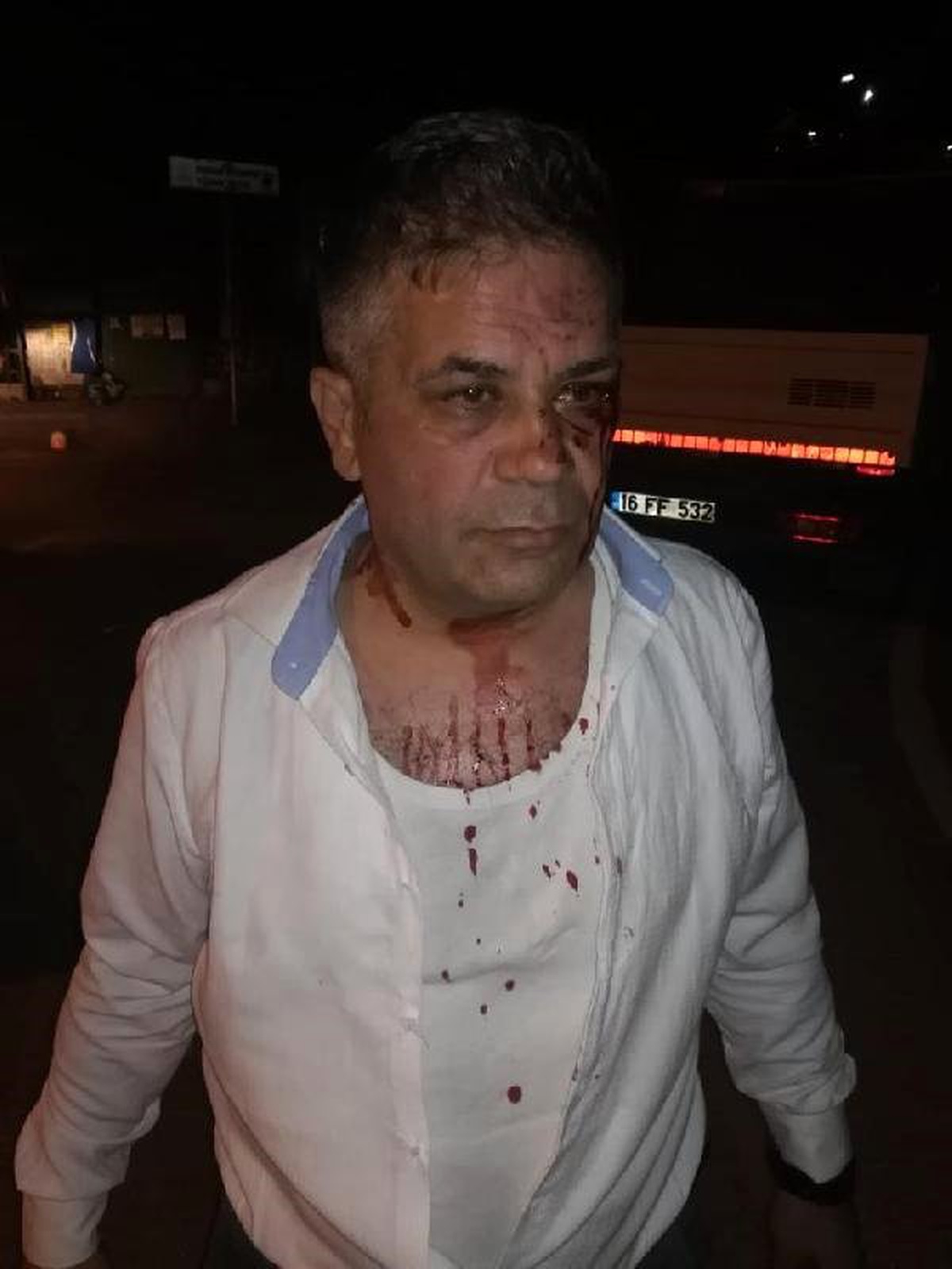 Bursa\'da İYİ Parti\'li meclis üyesi, 4 kişinin saldırısına uğradı