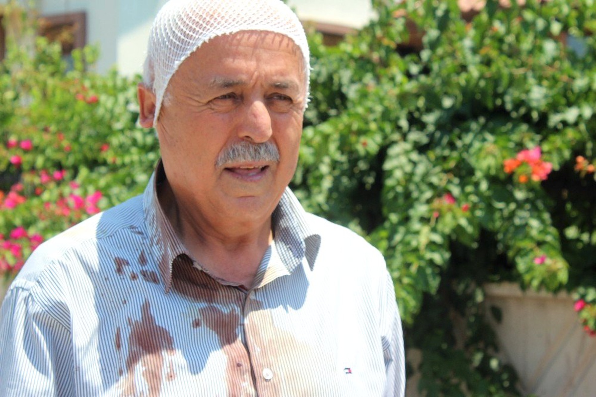 Manavgat\'ta sokak köpeklerinin saldırdığı yaşlı adam hastanelik oldu