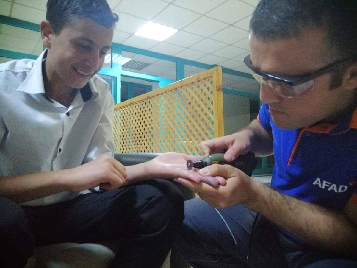 AFAD ekipleri, parmakta sıkışan yüzüğü çıkarttı