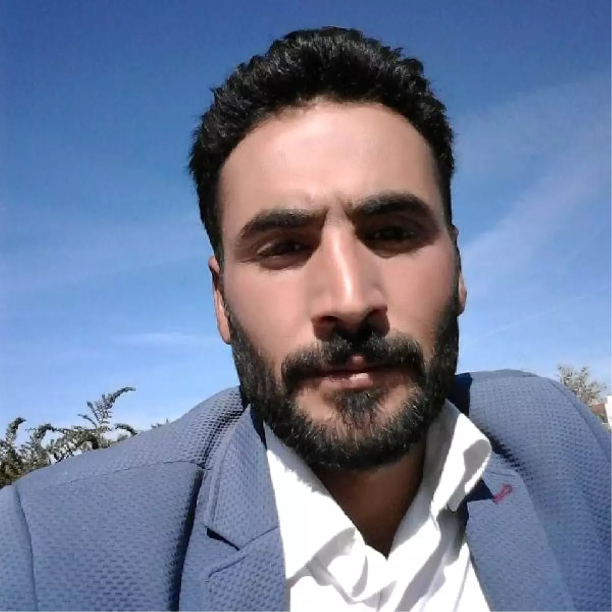 Vücuduna yapışan keneyi kendi çıkaran çoban, öldü