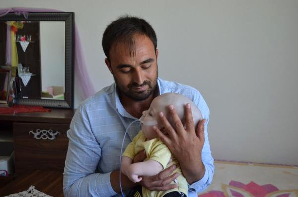 1 yaşındaki Yunus Emre\'ye devlet sahip çıktı