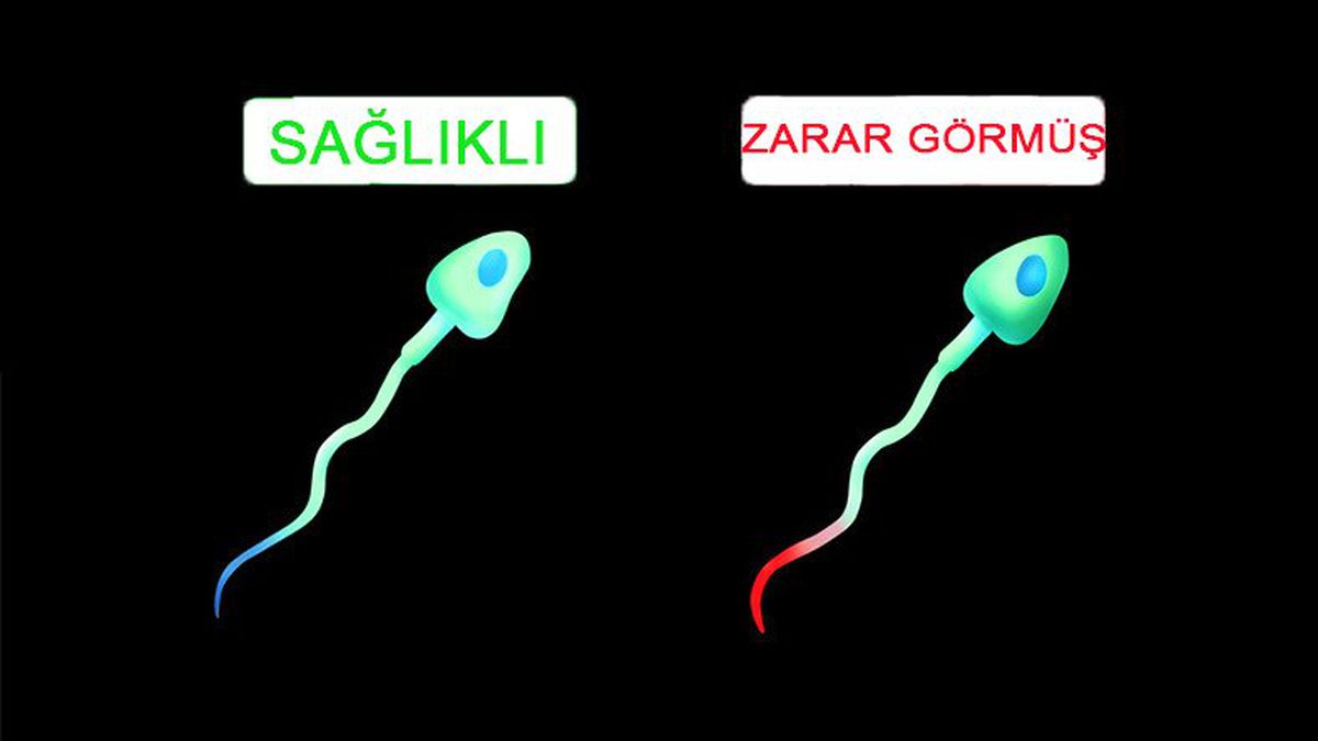 Bir Çalışma, WiFi\'ın Erkeklerin Sperm Sayısını Düşürdüğünü Gösteriyor