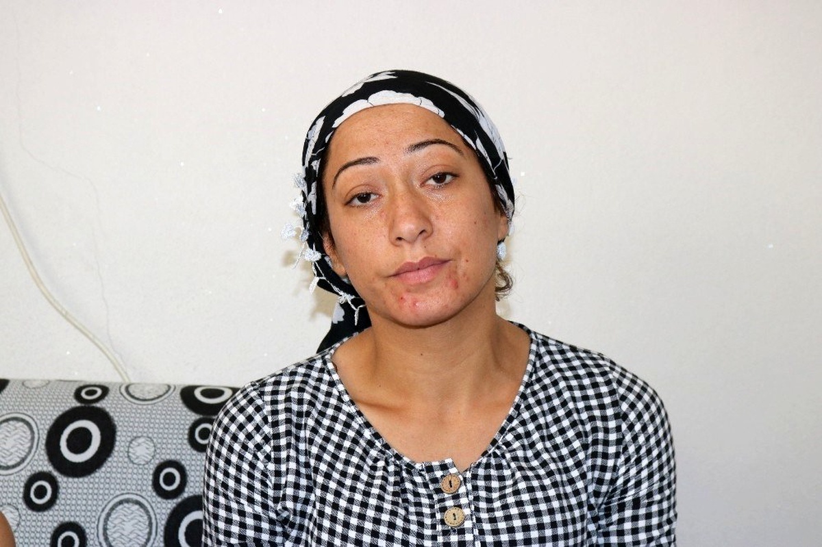 İki böbreği iflas eden acılı anne çocukları için yardım bekliyor