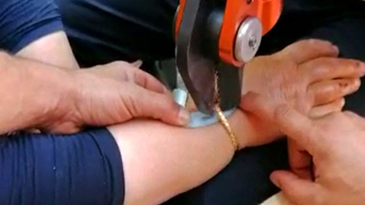 Şişen bileğindeki bileziği itfaiye çıkardı