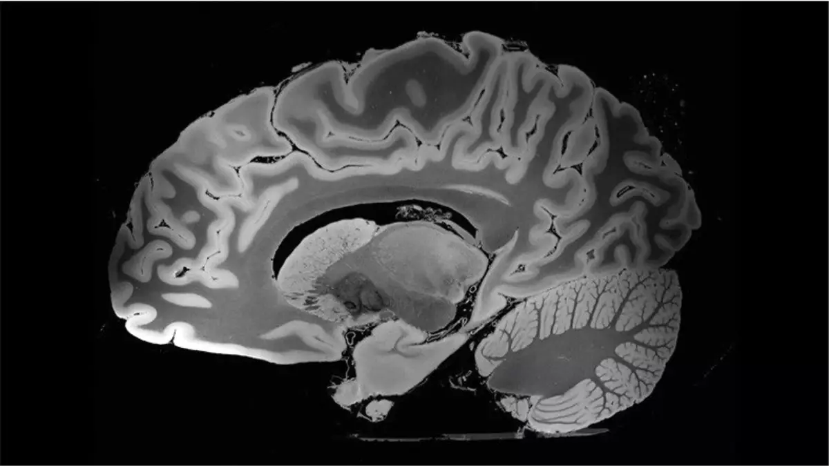 İnsan Beyninin 100 Saatlik MR ile Elde Edilen Ultra Yüksek Çözünürlüklü 3D Görüntüsü (Video)