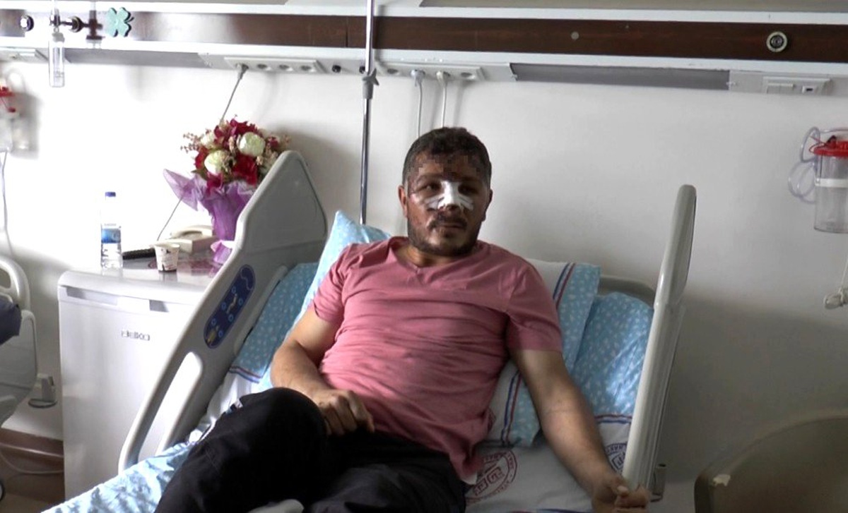Motosiklet kaskı kırık diye takmayan sürücü dehşeti yaşadı