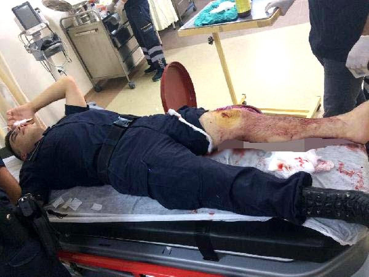 Hastanede kavgayı ayırmak isteyen Jandarma yaralandı