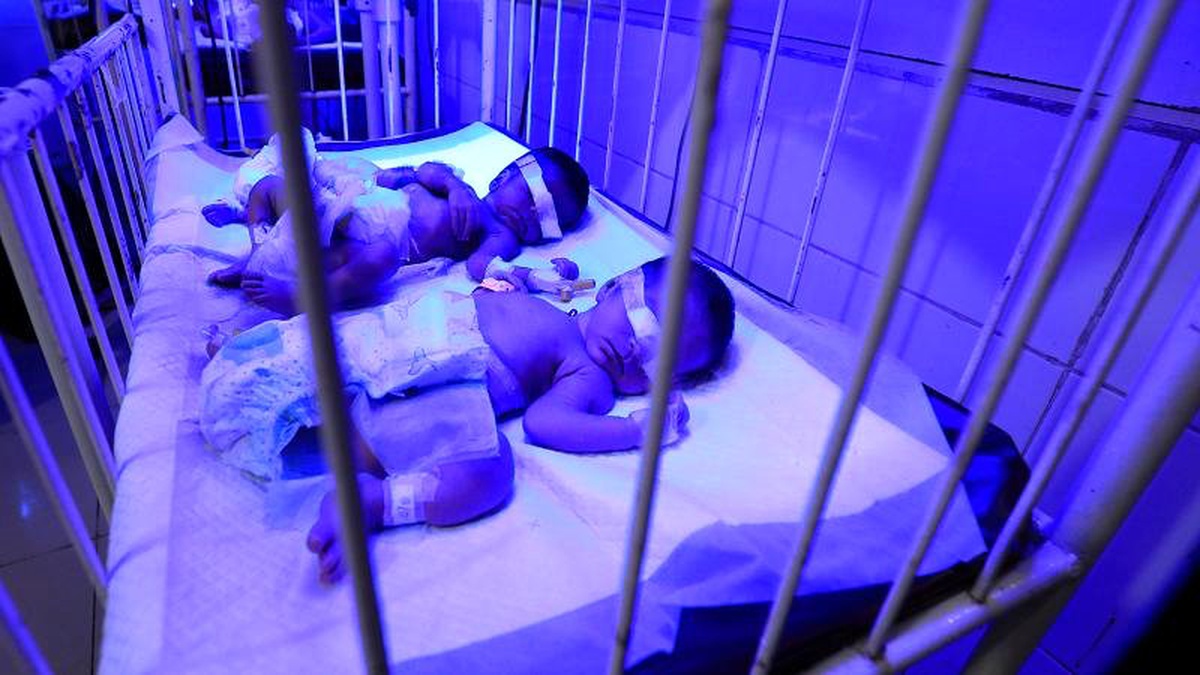 Türkiye\'de bebek ölüm oranları AB ortalamasını yaklaşık üçe katladı (Eurostat)