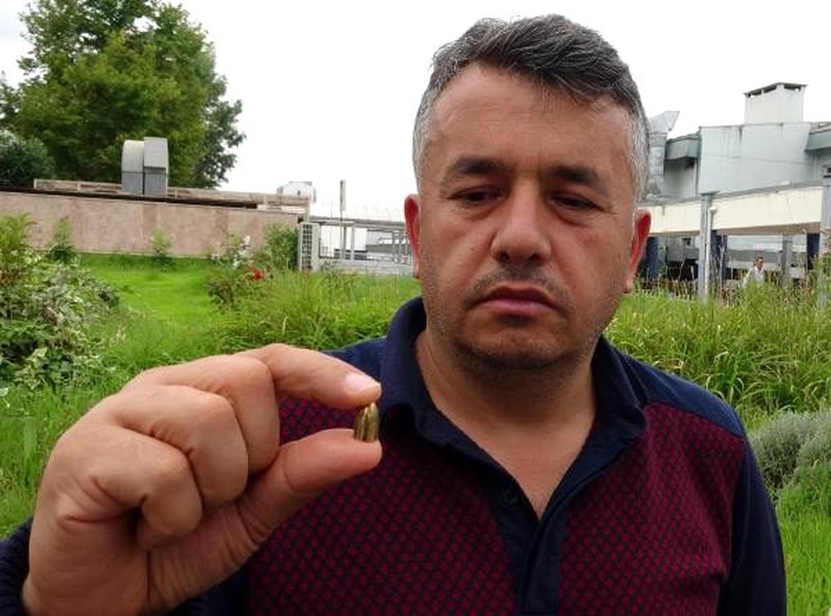 Burak, kaşına isabet eden maganda kurşunuyla yaralandı (2)