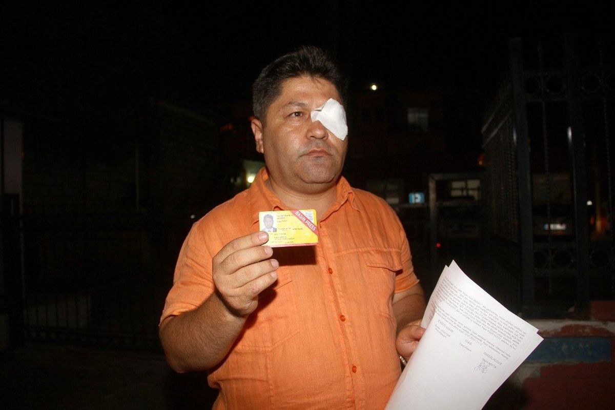 Fethiye\'de gazeteciye saldırı