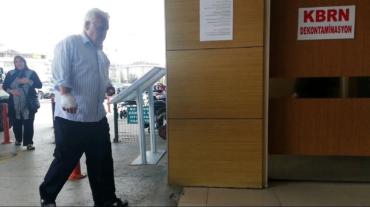 Şarjlı bisiklet ile otomobil böyle çarpıştı