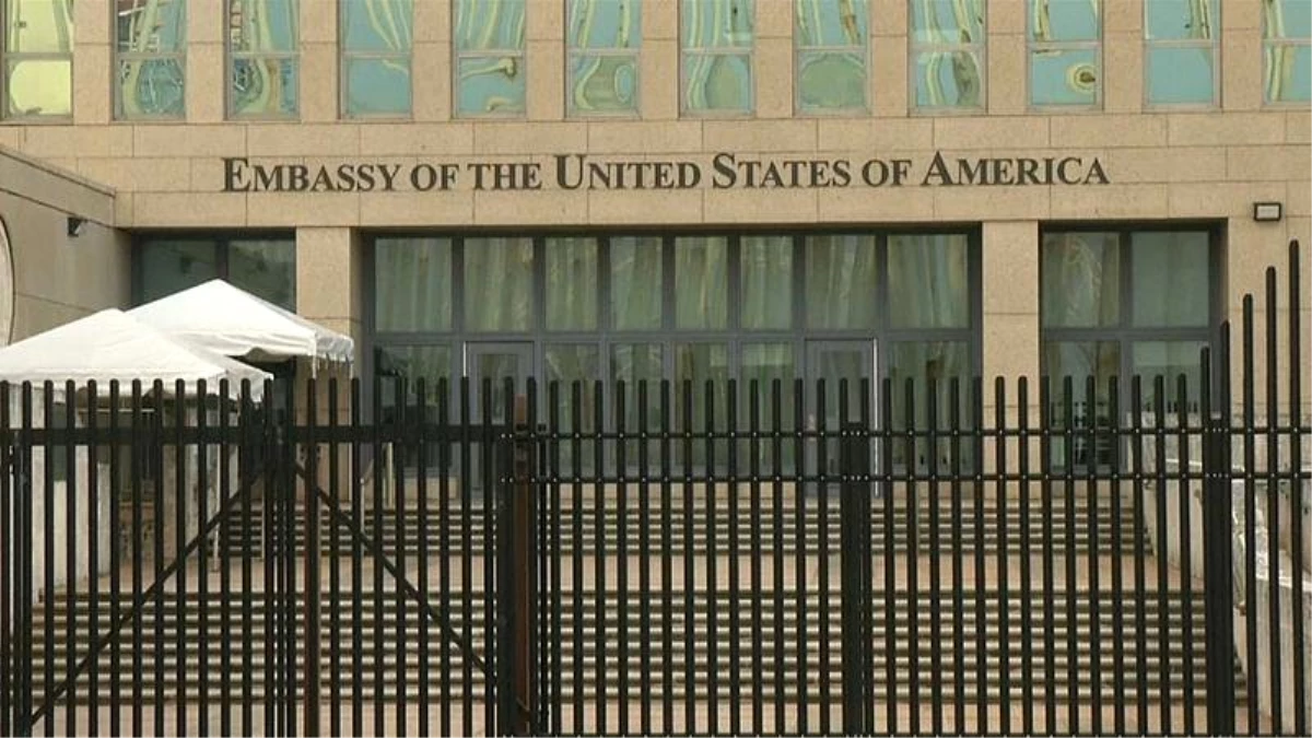 ABD-Küba \'sonik saldırı\' krizi: Diplomatların beyin tomografisinde \'somut farklılıklar\' saptandı
