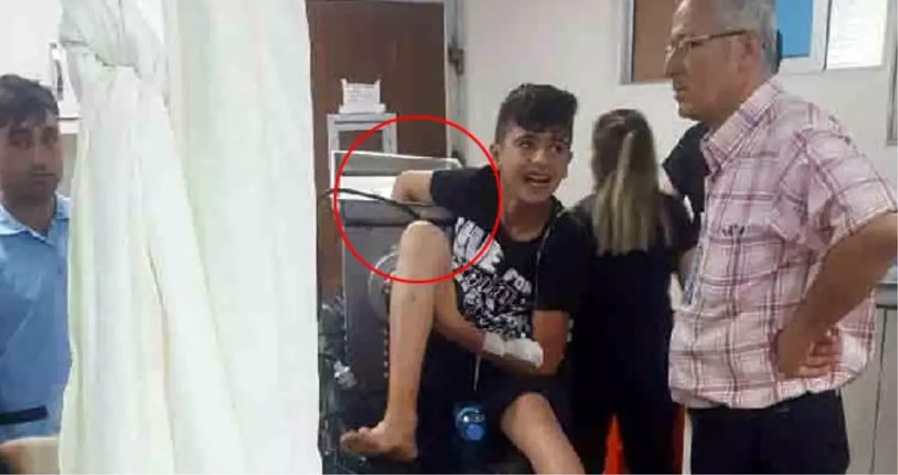 Gaziantep\'te 14 yaşındaki çocuk elini kıyma makinesine kaptırdı