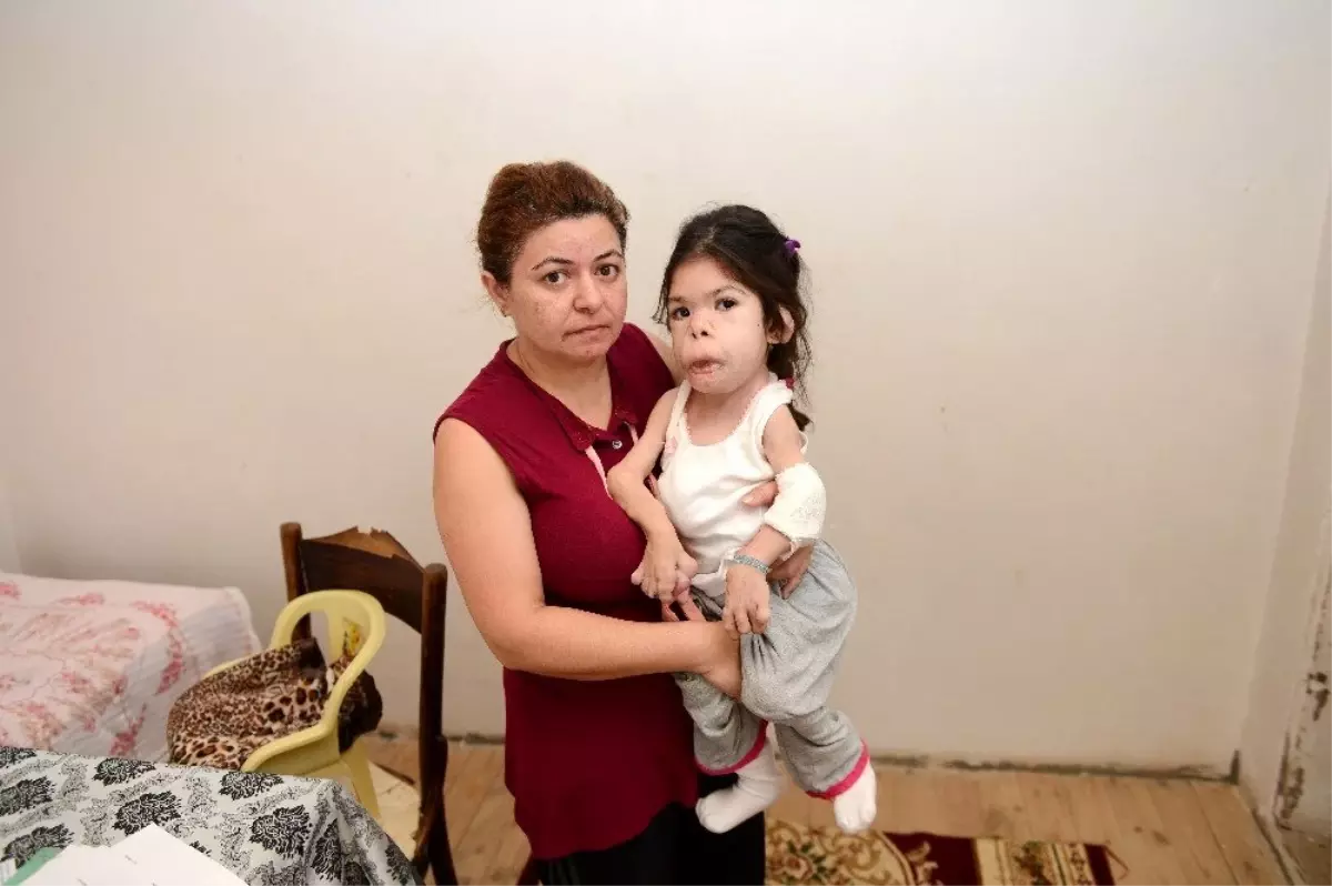 (ÖZEL) Maddi imkansızlıklar yüzünden iyileşemeyen 14 yaşındaki Zarife, yardım bekliyor