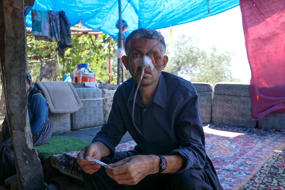 Dişini çektirdikten sonra gözünü kaybettiği iddiası