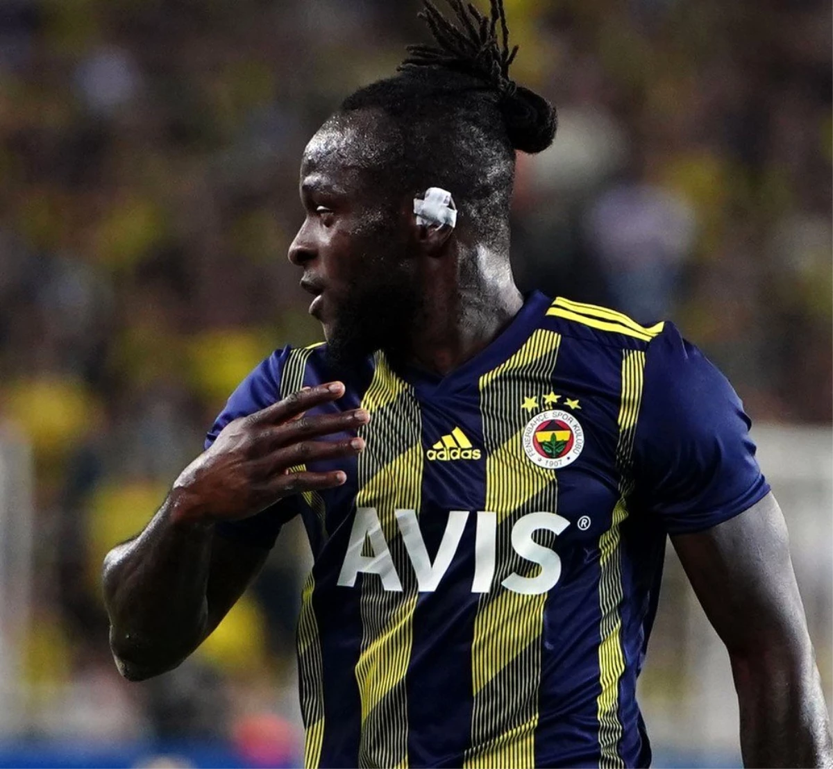 Fenerbahçe\'nin Gazişehir Gaziantep ile oynadığı maçta sakatlanan Victor Moses\'ın 5 hafta sahalardan...