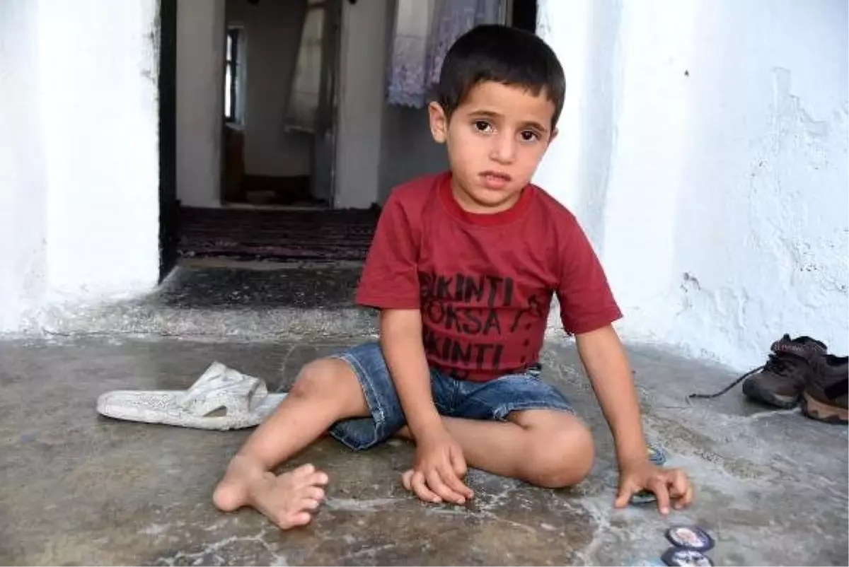 Doğuştan tibial hemimelia hastası olan Suriyeli Ahmed şifa arıyor