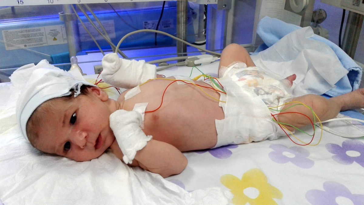 36 günlük Asel bebek için ailesi Cumhurbaşkanı Erdoğan\'dan yardım istedi