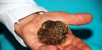 Mesanesinde 220 gramlık tek parça taş çıktı