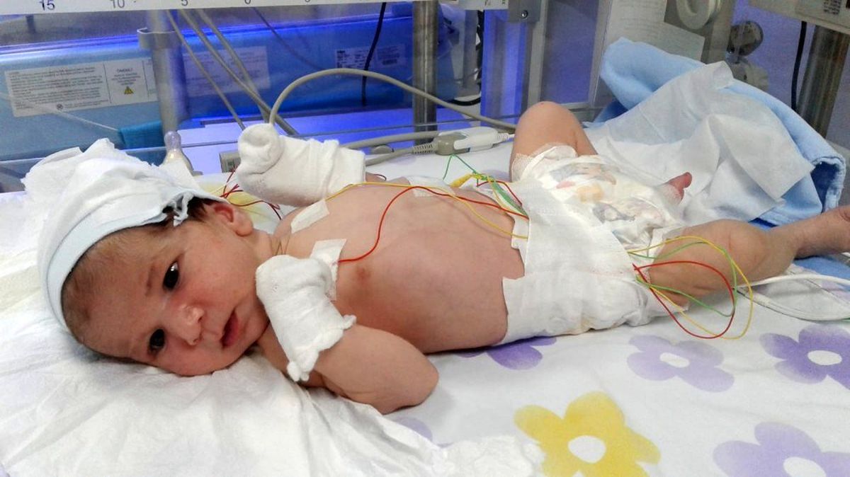 (Özel) Asel bebek için \'yaşatın\' çığlığı