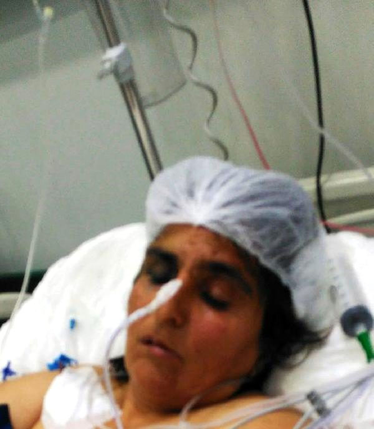 Eşi öldüresiye dövdü, hastanede \'merdivenden düştü\' denildi