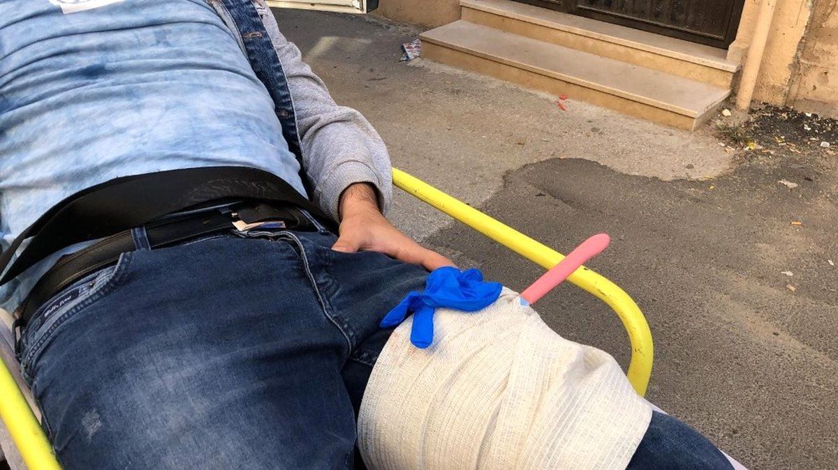 Gasp ettiler, dizine bıçak sapladılar