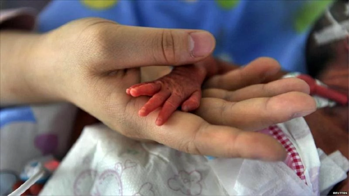 ABD\'de bir hastanede kürtaj ile doğan bebeklere \'ölüm odaları\' tahsis edildi