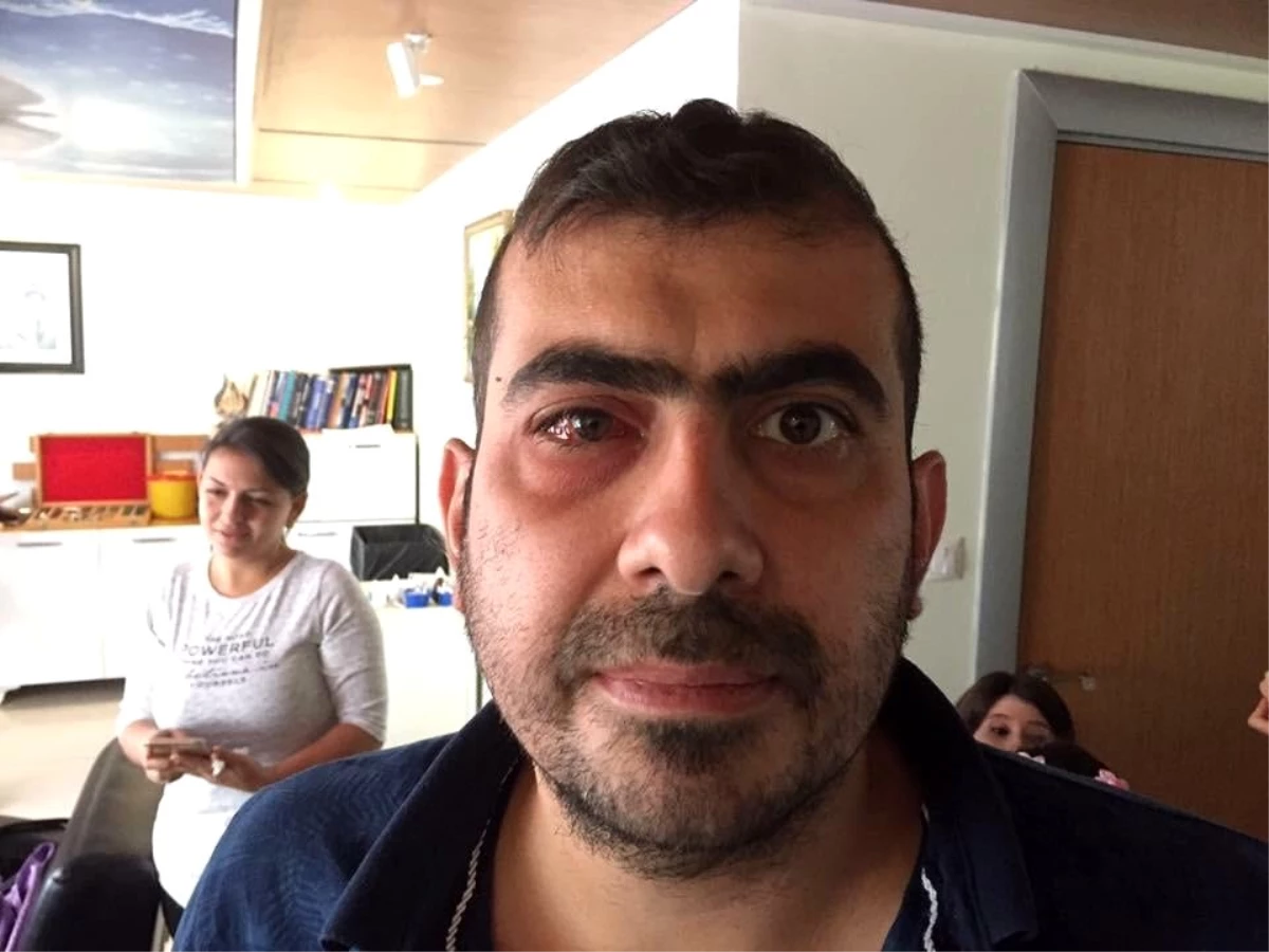 Iraklı hasta şifayı Kayseri Doktoröz Göz ve Cerrahi Merkezi\'nde buldu