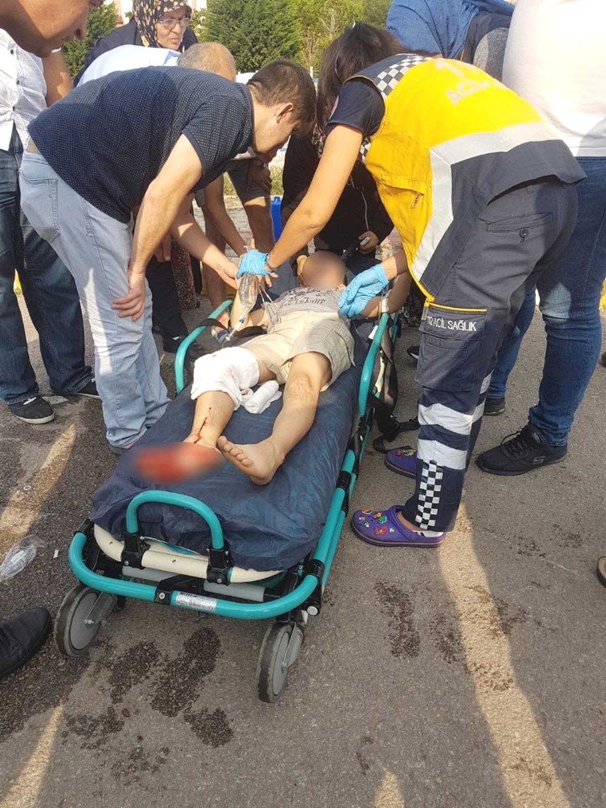 Bisikletten düşen çocuğun ayağına demir saplandı