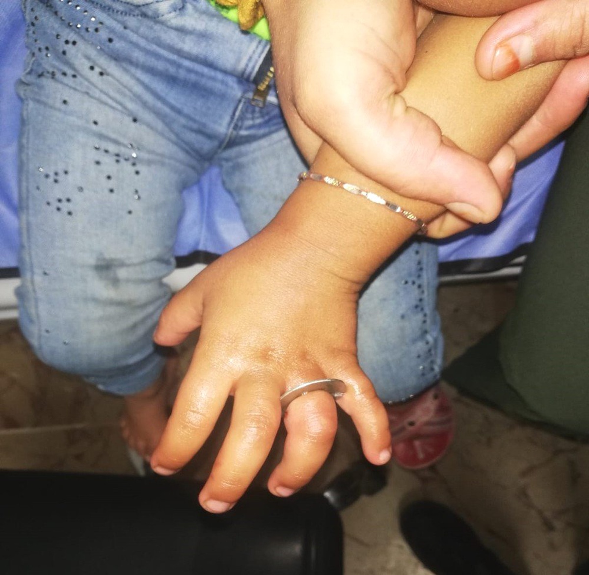 Parmağına sıkışan cıvata pulunu itfaiye ekipleri çıkardı