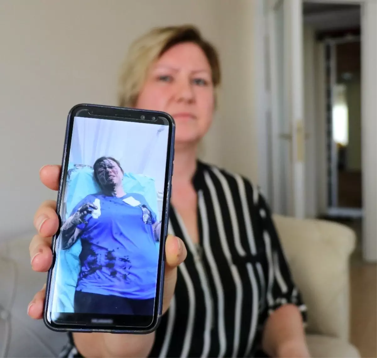 İş kadınına yanıcı madde döken zanlılar serbest