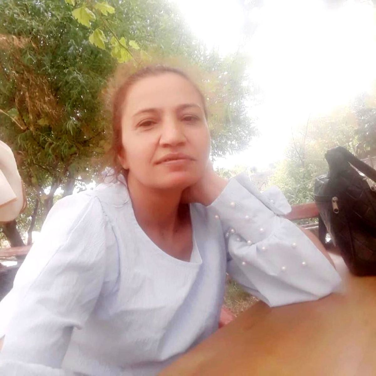 Eski eşi tarafından kezzap atılan kadın yaşama tutunamadı
