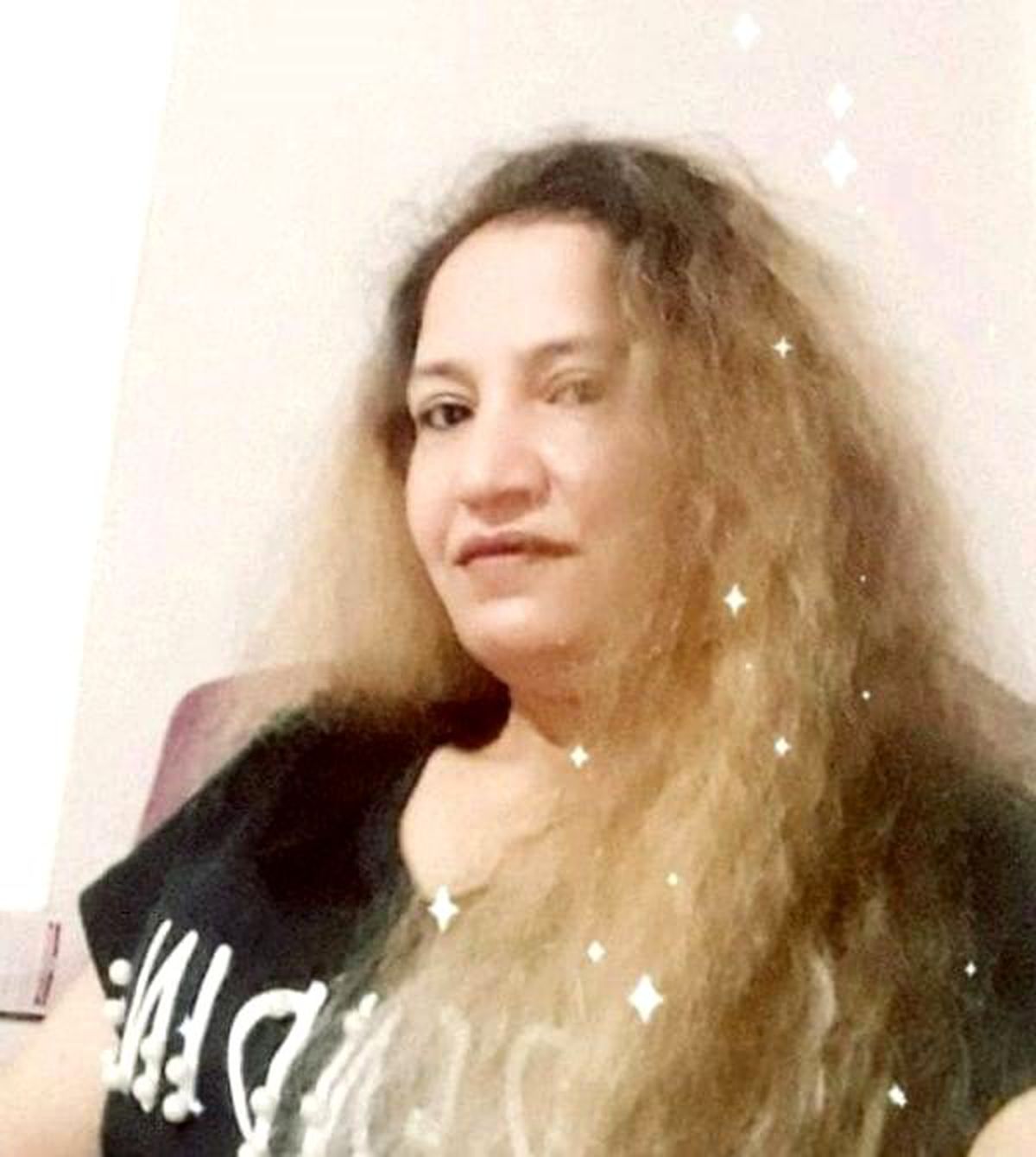 Eski eşi tarafından yüzüne kezzap atılan kadın yaşam mücadelesini kaybetti