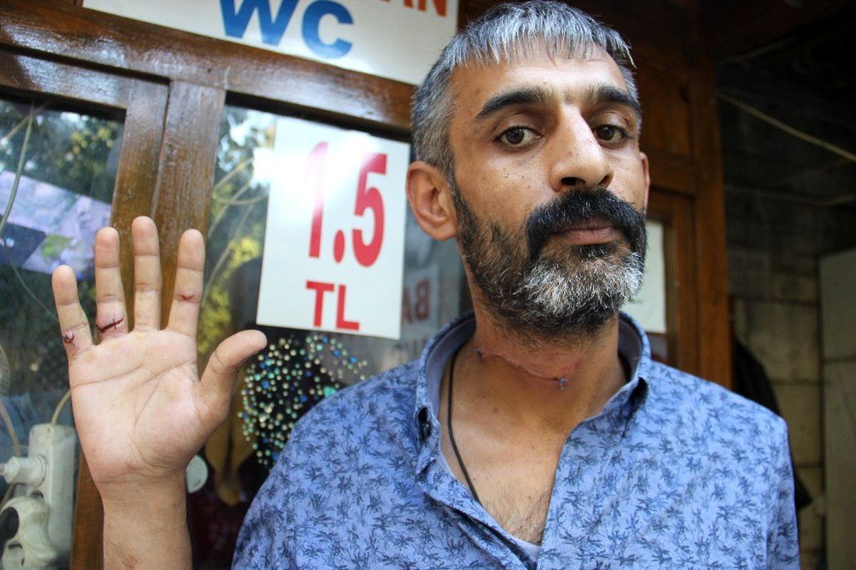 Olayda ağır yaralanan tuvalet bekçisi konuştu
