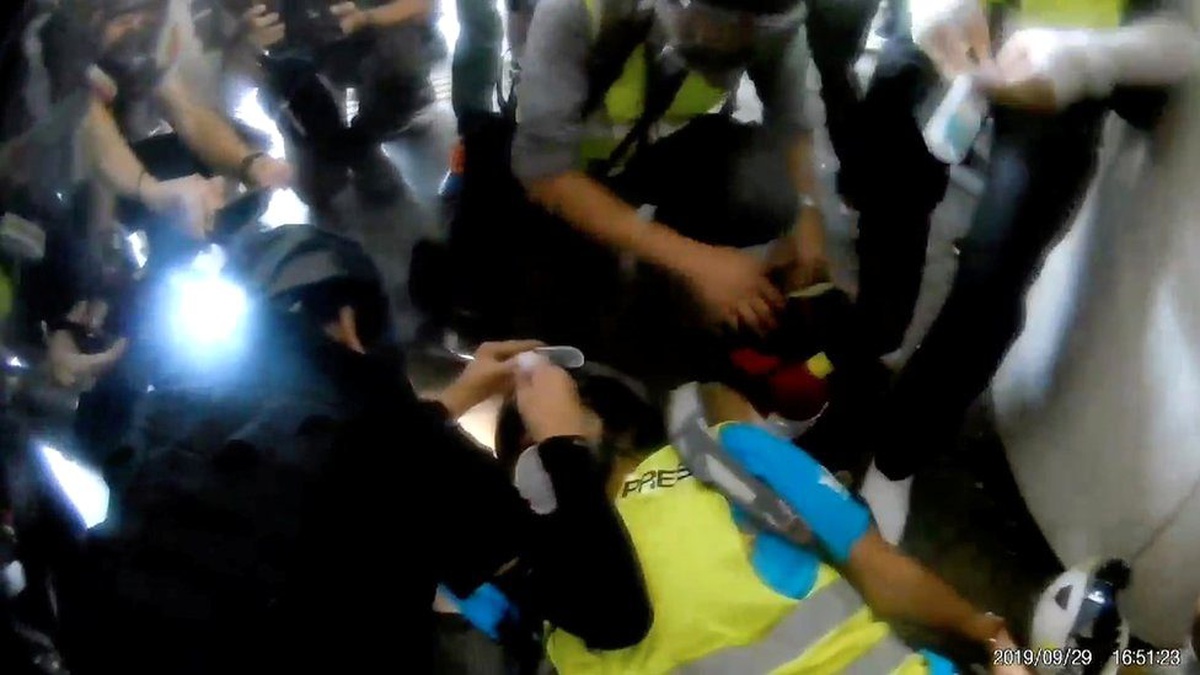 Hong Kong\'da gözünü kaybeden gazeteci: Polislere gazeteci olduğumuzu söyledik, ateş ettiler