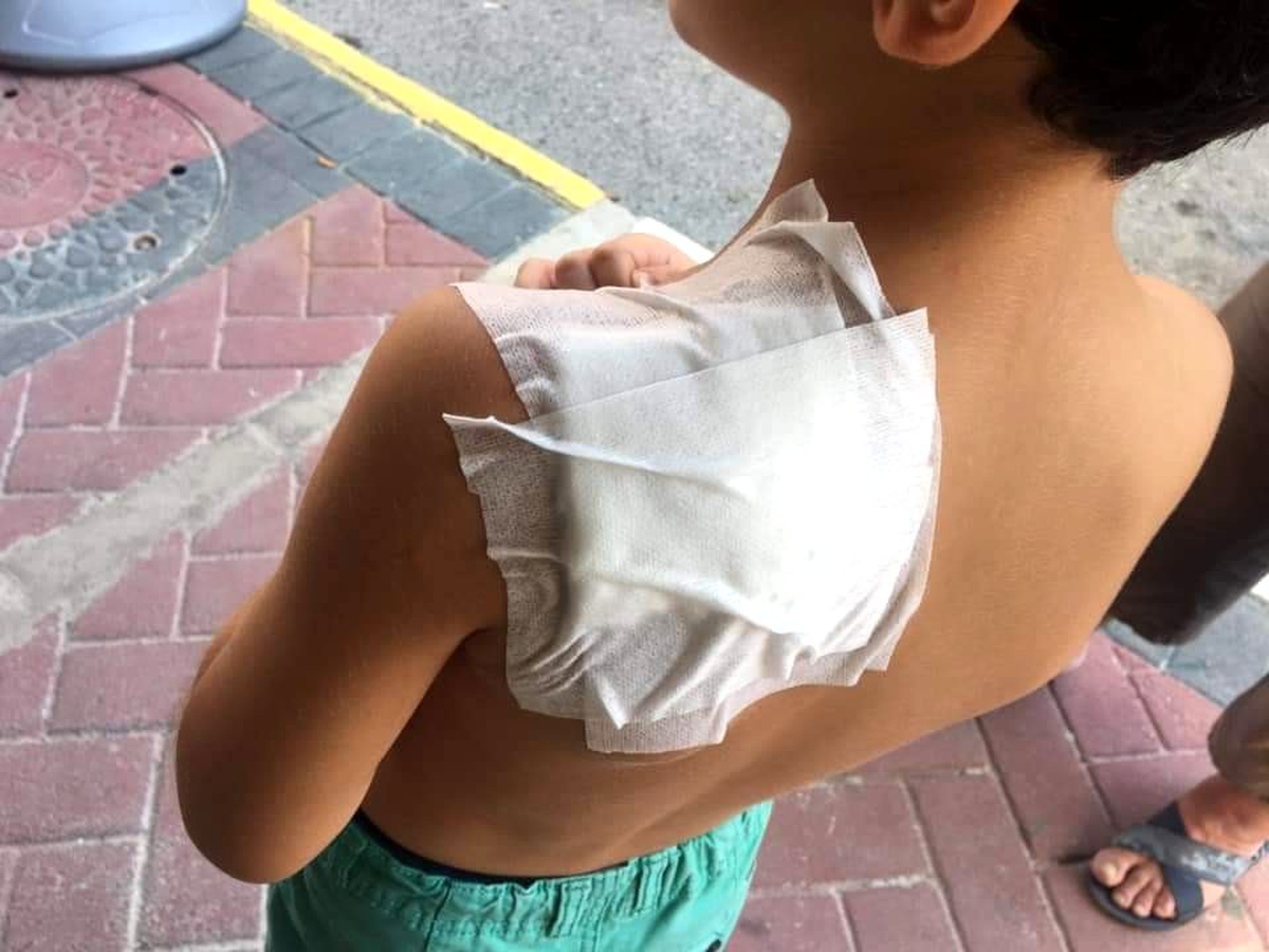 Antalya\'da ilkokul öğrencisi, okul dönüşü sokak kopeğinin saldırısına uğradı