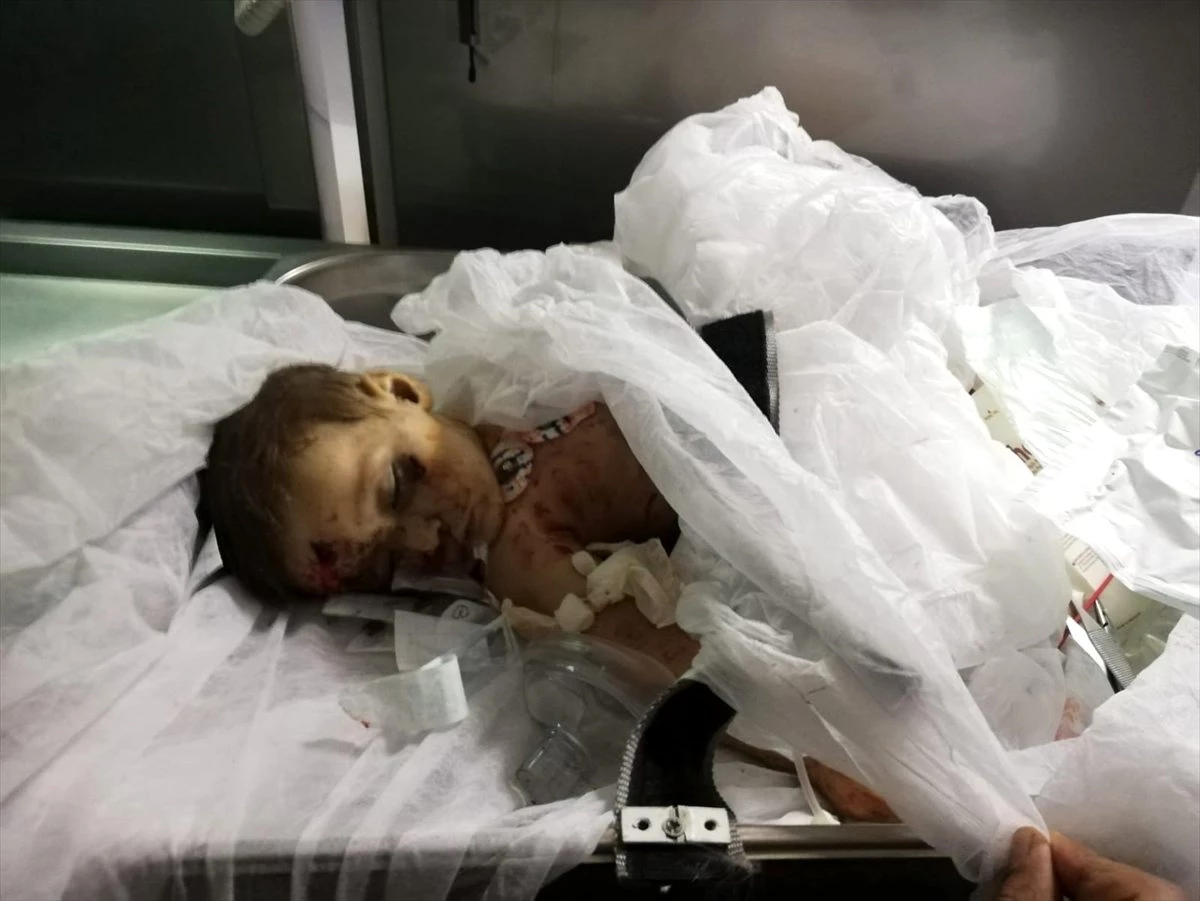 9 aylık Muhammed bebek YPG/PKK\'nın kurbanı oldu