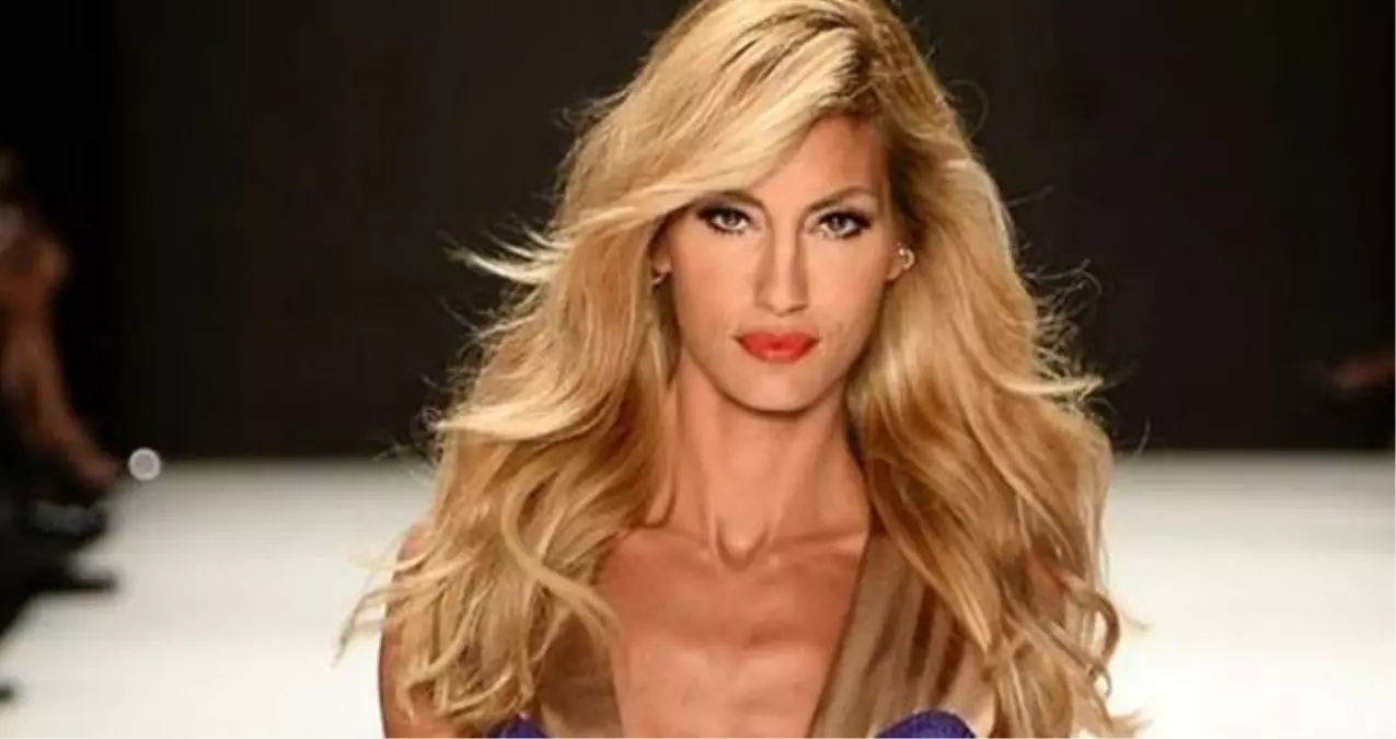 Çağla Şıkel canlı yayında göğsünün açılmasıyla ilgili ilk kez konuştu