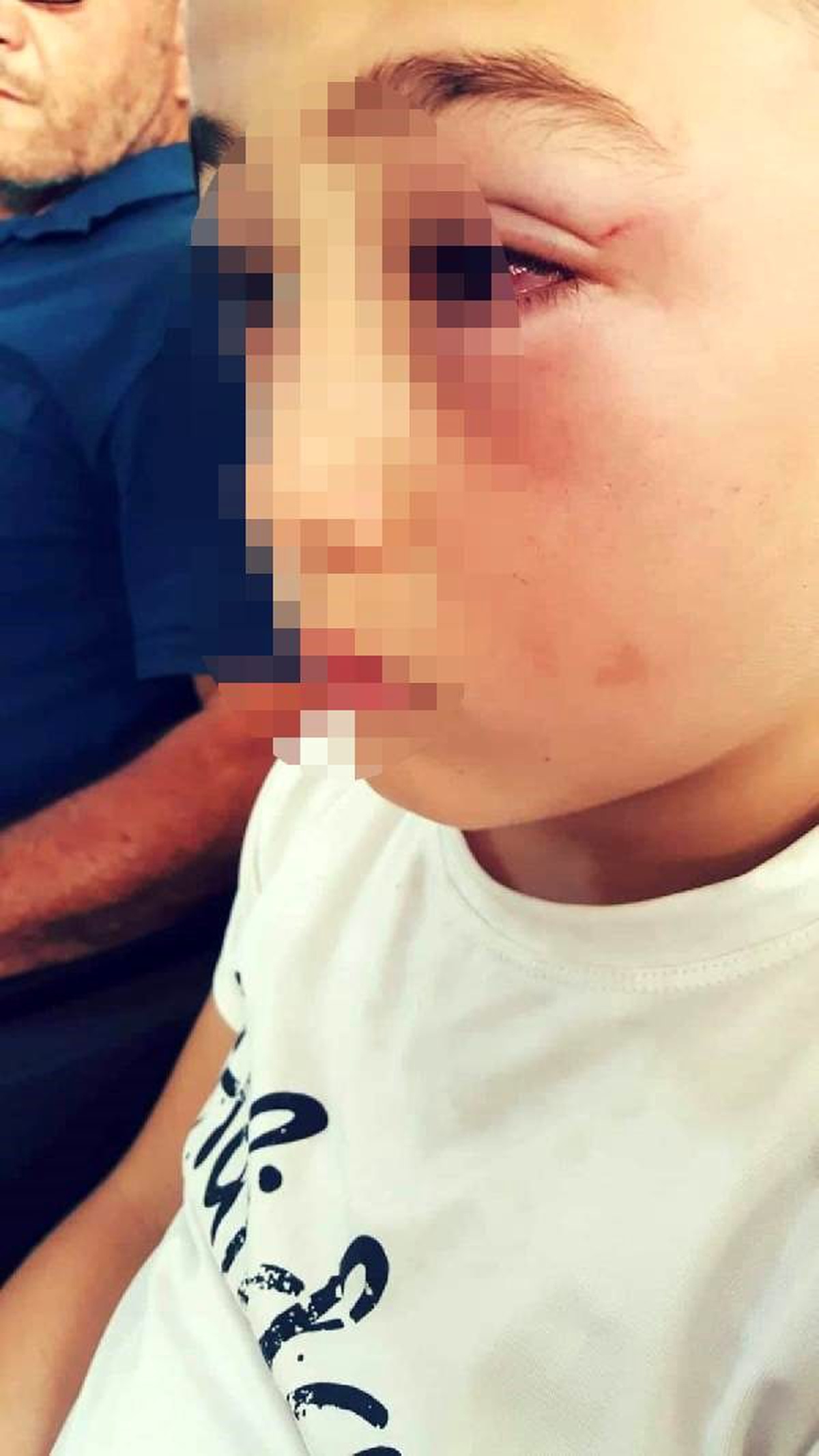 Oğluna su atan çocuğu dövdüğü iddiasıyla gözaltına alındı