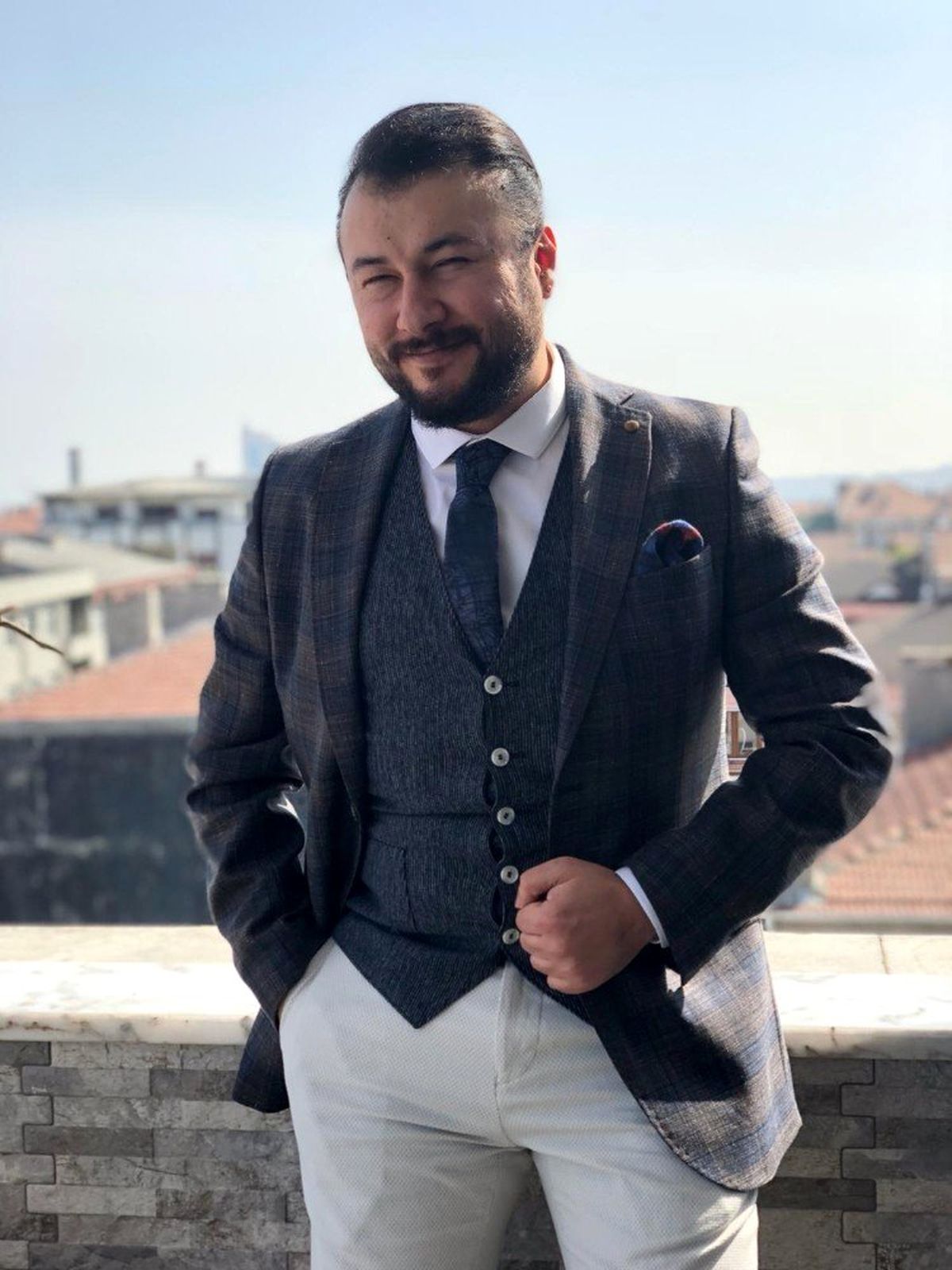 Saç ekimi öncesi bunlara dikkat