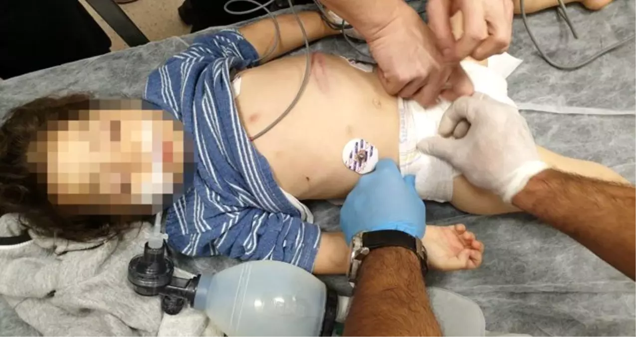 "Üzerine motosiklet düştü" denmişti! Komaya giren çocuğu üvey annesinin dövdüğü ortaya çıktı