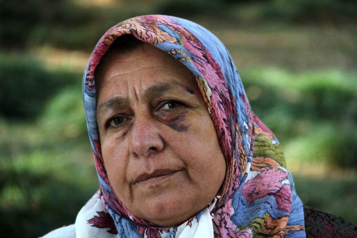 Komşu tarafından darp edilen kadın gözyaşlarına boğuldu