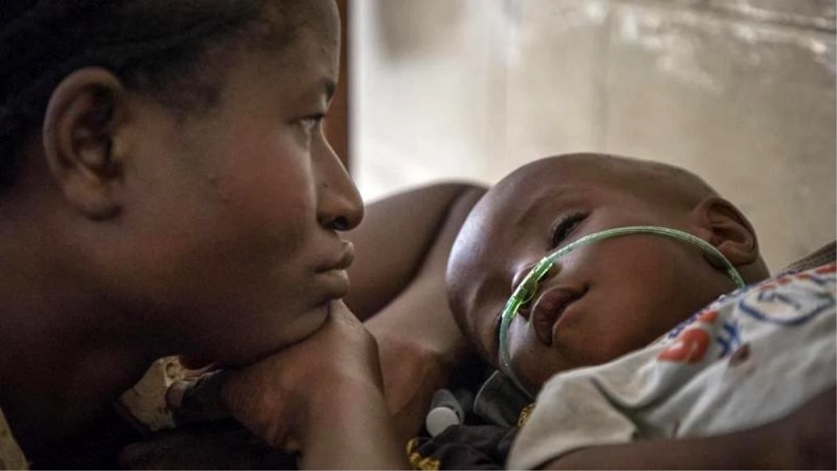 Her 39 saniyede bir çocuk zatürre yüzünden ölüyor: Çoğu yaşamının ilk aylarında