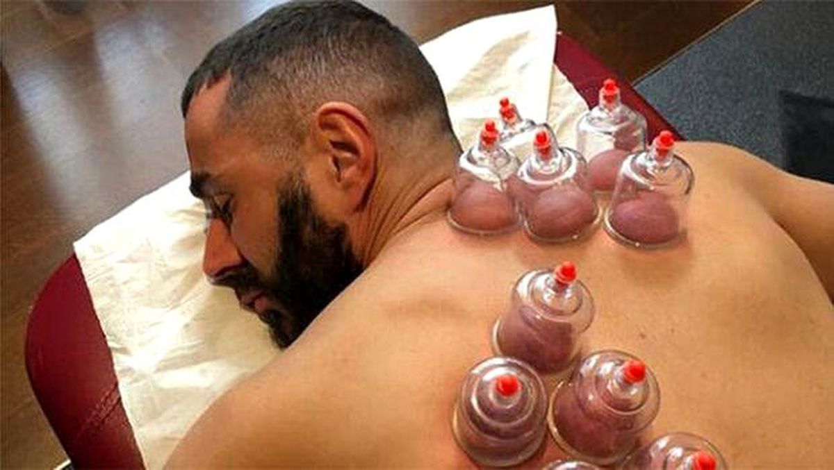 Karim Benzema hacamat yaptırdı