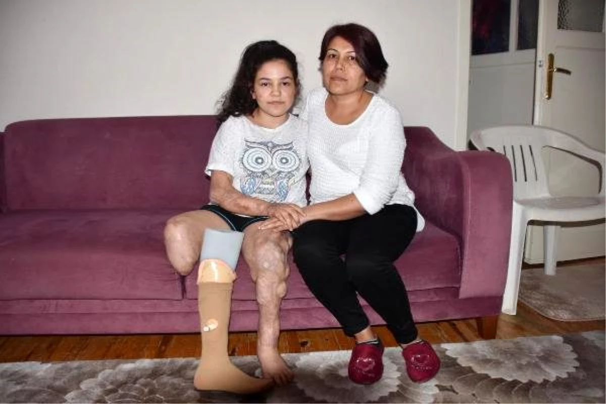 Menenjit yüzünden bacağını kaybeden Melis, yardım istiyor
