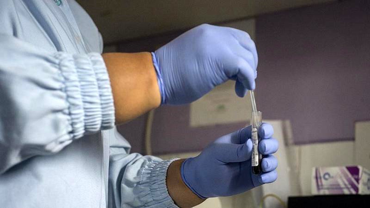 Türkiye\'de HIV pozitif sayısı yıldan yıla artıyor: Tek çözüm, farkındalığı artırmak