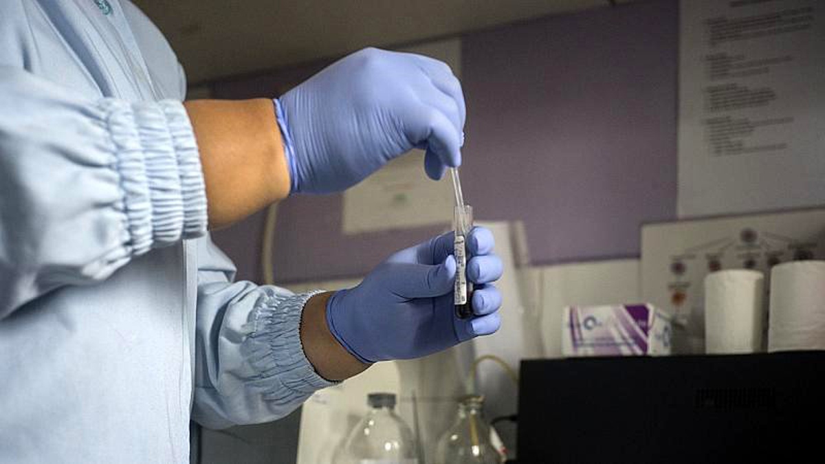 DSÖ: Avrupa\'da HIV taşıyan kadınların yarısından fazlası geç teşhis mağduru