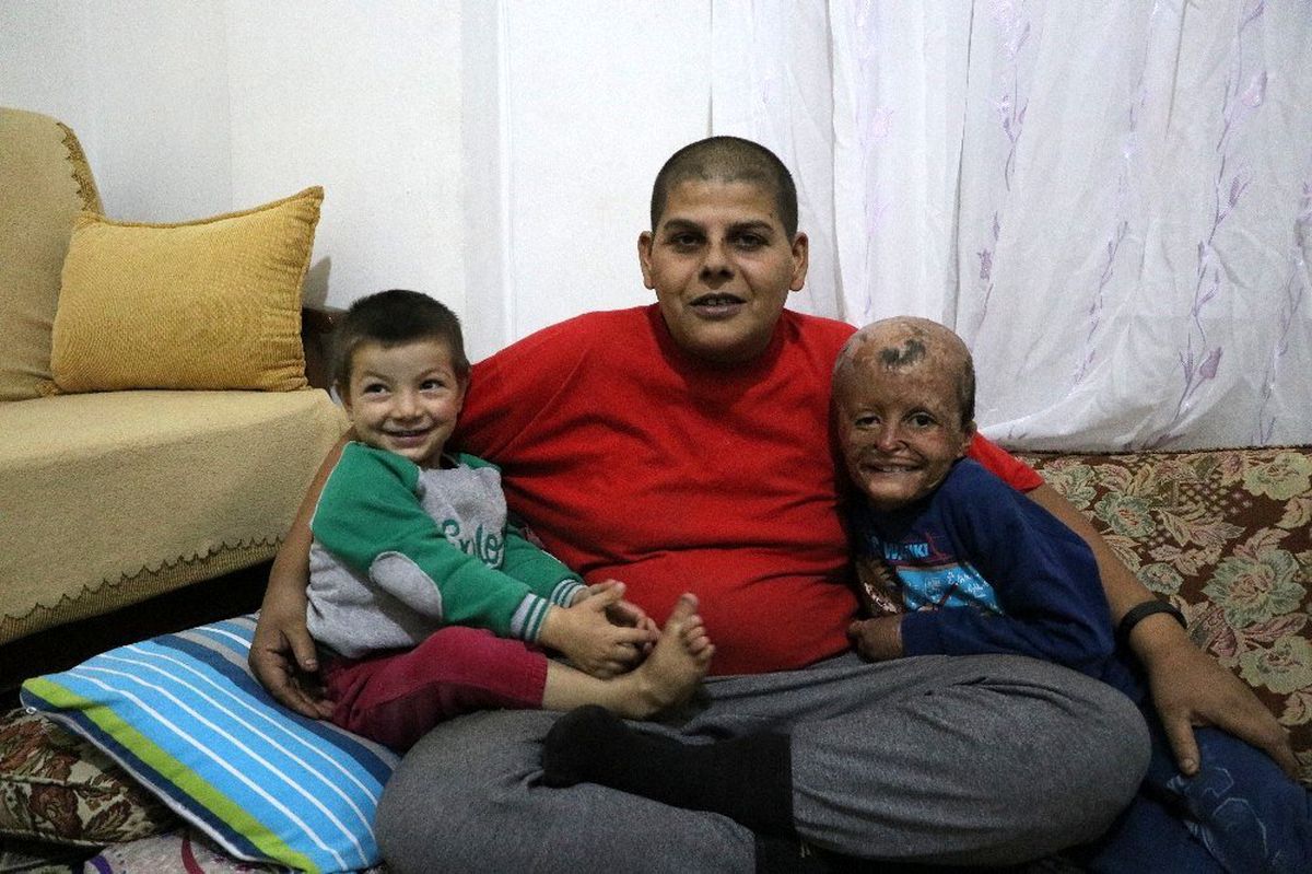 Savaş mağduru Muhammed amcasına kavuştu